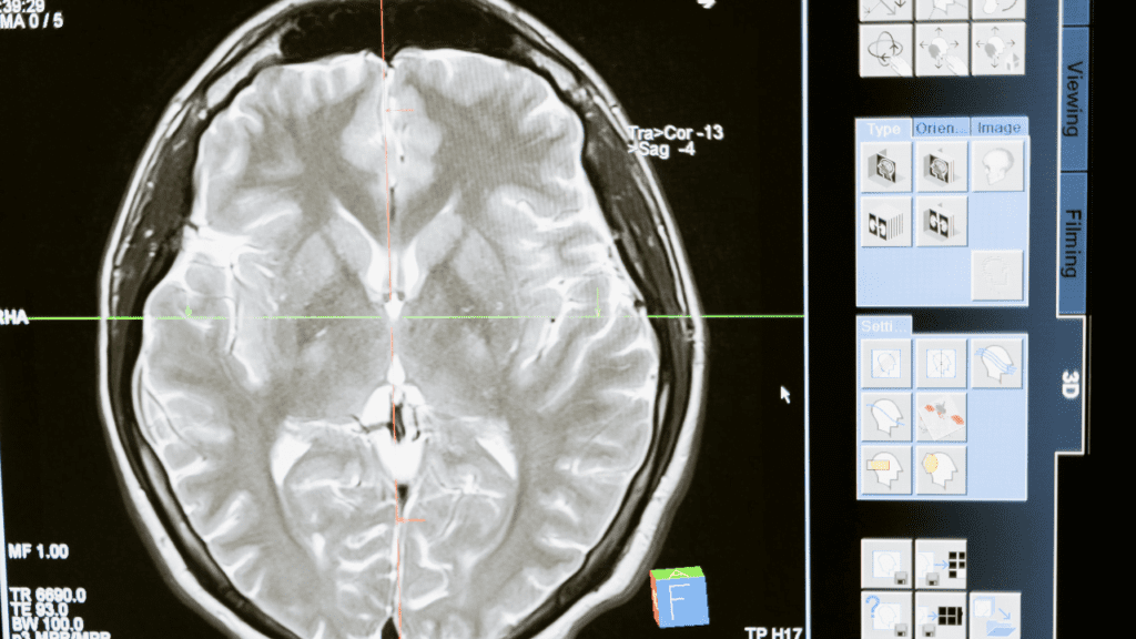 Medical image analysis